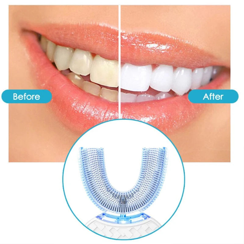 Blanchisseur de dents intelligent automatique à lumière bleue en forme de U